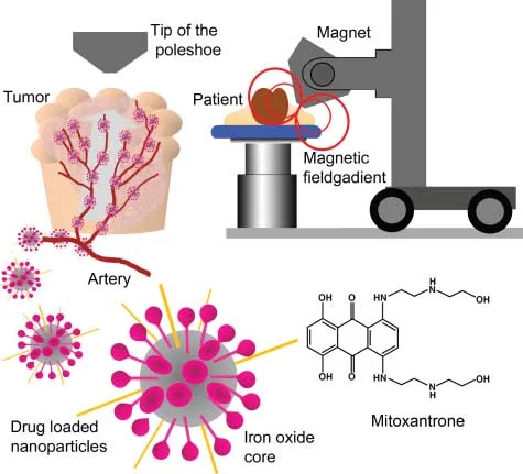 Diagrama: Utilização de ímãs no tratamento de câncer, direcionando nanopartículas com mitoxantrona a um tumor.