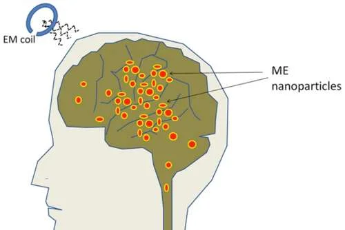 Diagrama ilustra ativação de neurônios: cérebro com nanopartículas ME sob bobina EM. Ativando com ímãs.