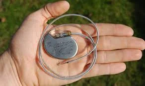 Marcapasso prateado com fios enrolados, apoiado na palma de uma mão, sobre fundo verde desfocado.