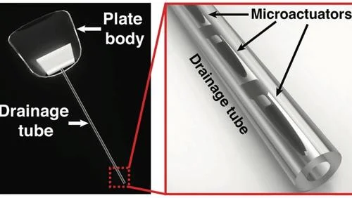 Implante de drenagem para glaucoma: tubo transparente com microatuadores e corpo de placa retangular.